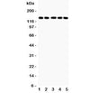 Western blot testing of Collagen 2 antibody and human samples 1: COLO320; 2: HeLa; 3: MCF-7; 4: A549; 5: Jurkat lysate. Predicted molecular weight ~140 kDa.