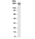 Western blot testing of human kidney lysate with IQGAP1 antibody at 1ug/ml. Predicted molecular weight ~189 kDa.