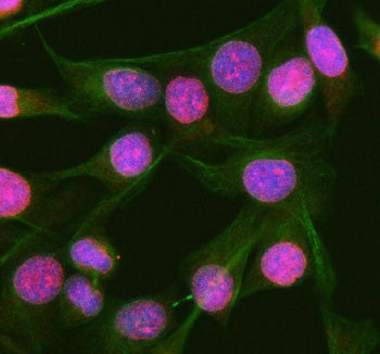 Immunofluorescent staining of RGL3 using anti-RGL3 antibody (red) and anti-Beta Tubulin antibody (green). RGL3 was detected in immunocytochemical section of human HeLa cells. Enzyme antigen retrieval was performed using IHC enzyme antigen retrieval reagent for 15 mins. The cells were blocked with 10% goat serum. And then incubated with 5 ug/ml rabbit anti-RGL3 antibody and mouse anti-Beta Tubulin antibody overnight at 4oC.