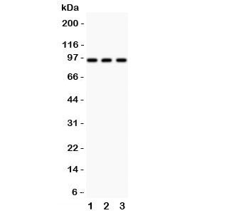 Western blot testing of TBK1 antibody and Lane 1: HeLa; 2: rat testis; 3: rat liver; Predicted molecular weight: ~84 kDa.