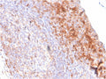 IHC staining of FFPE human tonsil with CD80 antibody (clone C80/3544). HIER: boil tissue sections in pH 9 10mM Tris with 1mM EDTA for 20 min and allow to cool before testing.
