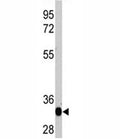 Western blot analysis of recombinant protein with LIN28A antibody