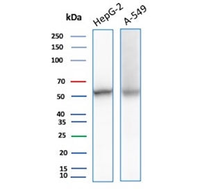 Western blot testing of human HepG2 and A549 cell lysate with NSE Gamma antibody (clone ENO/8632R). Predicted molecular weight ~47 kDa.