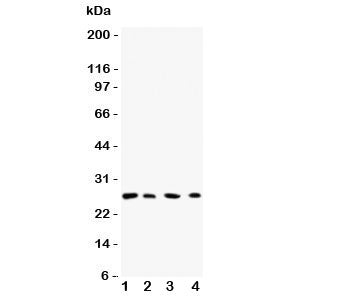 Western blot testing of Rab3C antibody and Lane 1: rat brain; 2: human HeLa; 3: (h) 293T; 4: (h) COLO320 lysate. Expected/observed size ~26KD