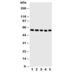 Western blot testing of ERp57 antibody and Lane 1: SMMC-7721; 2: A549; 3: U87; 4: HeLa; 5: MCF-7 cell lysate. Predicted molecular weight: ~57-60kDa.