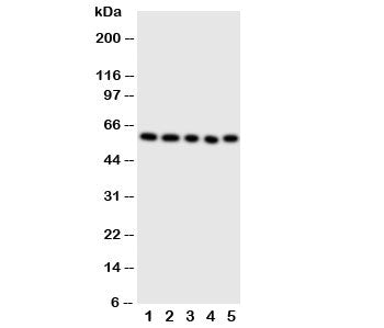 Western blot testing of ERp57 antibody and Lane 1: SMMC-7721; 2: A549; 3: U87; 4: HeLa; 5: MCF-7 cell lysate. Predicted molecular weight: ~57-60kDa.
