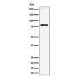 Western blot testing of human Raji cell lysate with LTK antibody. Predicted molecular weight: ~92 kDa, ~86 kDa, ~79 kDa and additional smaller isoforms.