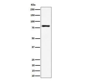 Western blot testing of human Raji cell lysate with LTK antibody. Predicted molecular weight: ~92 kDa, ~86 kDa, ~79 kDa and additional smaller isoforms.