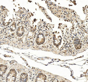 IHC staining of FFPE human small intestine tissue with Hephaestin antibody, HRP-secondary and DAB substrate. HIER: boil tissue sections in pH8 EDTA for 20 min and allow to cool before testing.