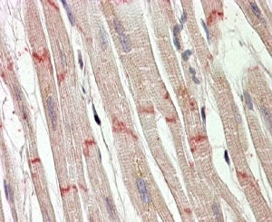 IHC testing of FFPE human heart with Desmoplakin antibody at 4ug/ml. HIER: steamed with pH6 citrate buffer, AP-staining. Cardiomuscular fiber junction staining seen.