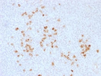 IHC testing of human tonsil and IgG antibody. Required HIER: boil tissue sections in 10mM citrate buffer, pH 6, for 10-20 min followed by cooling at RT for 20 min.
