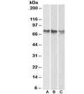 Western blot of human A) HepG2, B) K562 and C) HeLa cell lysate (nuclear fractions) with ATF2 antibody at 1ug/ml. Expected molecular weight: 65-70 kDa.