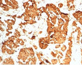 IHC staining of FFPE human pituitary gland tissue with HCG-beta antibody (clone HCGb/7201R). HIER: boil tissue sections in pH 9 10mM Tris with 1mM EDTA for 20 min and allow to cool before testing.
