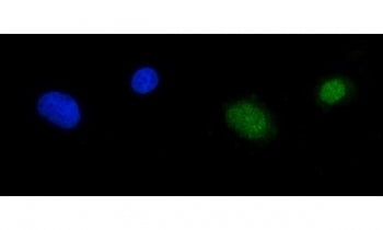 Immunofluorescent staining of FFPE human A549 cells with RPA1 antibody (green) and DAPI nuclear stain (blue). HIER: steam section in pH6 citrate buffer for 20 min.