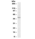 Western blot testing of K562 lysate with TRIP6 antibody at 2ug/ml. Predicted molecular weight: ~50kDa.