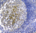 IHC staining of FFPE human tonsil tissue with PLK2 antibody. HIER: boil tissue sections in pH8 EDTA for 20 min and allow to cool before testing.