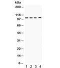 Western blot testing of 1) rat spleen, 2) rat thymus, 3) human placenta and 4) HeLa lysate with HDAC7 antibody. Expected/observed molecular weight ~103 kDa.