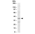 Western blot testing of human liver lysate with ARPC1B antibody at 2ug/ml. Predicted molecular weight: ~41 kDa.