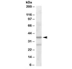 Western blot testing of human liver lysate with ARPC1B antibody at 2ug/ml. Predicted molecular weight: ~41 kDa.