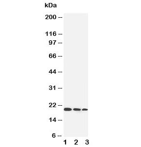 Western blot testing of IL-10 antibody and Lane 1: Recombinant human IL-10 protein 10ng; 2: 5ng; 3: 2.5ng