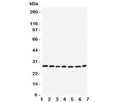 Western blot testing of EIF6 antbody; Lane 1: rat liver; 2: (r) kidney; 3: human COLO320; 4: (h) SW620; 5: (h) HeLa; 6: (h) 293T; 7: mouse HEPA cell lysate. Expected molecular weight ~27 kDa.