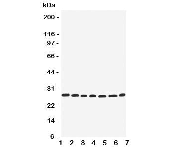 Western blot testing of EIF6 antbody; Lane 1: rat liver; 2: (r) kidney; 3: human COLO320; 4: (h) SW620; 5: (h) HeLa; 6: (h) 293T; 7: mouse HEPA cell lysate. Expected molecular weight ~27 kDa.
