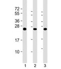 Western blot testing of human 1) A431, 2) HL-60 and 3) U2OS cell lysate with RAB5C antibody at 1:2000. Predicted molecular weight: 23 kDa.