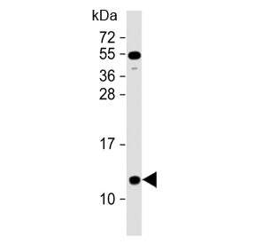 Western blot testing of human heart lysate with NDUFA2 antibody at 1:2000. Predicted molecular weight ~11 kDa.