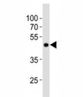 Western blot analysis of lysate from NCCIT cell line using POU5F1 antibody at 1:1000. Predicted molecular weight ~38/30kDa (isoform A/B), commonly observed at 38-45 kDa.