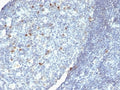 IHC: Formalin-fixed, paraffin-embedded human tonsil stained with anti-IgM antibody.