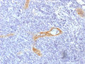 IHC testing of FFPE human tonsil with recombinant von Willebrand Factor antibody (clone rVWF/1465). Required HIER: boil tissue sections in pH 9 10mM Tris with 1mM EDTA for 10-20 min followed by cooling at RT for 20 min.