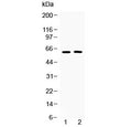 Western blot testing of human 1) COLO320 and 2) MCF7 cell lysate with Tubby antibody at 0.5ug/ml. Predicted molecular weight ~56/62 kDa (isoforms 1/2).