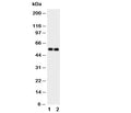 Western blot testing of GABA A Receptor alpha 1 antibody and Lane 1: rat brain; 2: rat brain tissue lysate