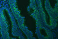 Immunofluorescent staining of FFPE human colon cancer tissue with TXNDC5 antibody (green) and DAPI nuclear stain (blue). HIER: steam section in pH6 citrate buffer for 20 min.