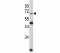 Western blot analysis of Lamin B2 antibody and Y79 lysate