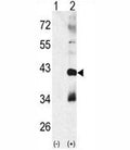 Western blot analysis of MAPK11 antibody and 293 cell lysate (2 ug/lane) either nontransfected (Lane 1) or transiently transfected with the MAPK11 gene (2).