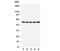 Western blot testing of NK1R antibody and Lane 1: A549; 2: U87; 3: COLO320; 4: SCG; 5: PANC cell lysate