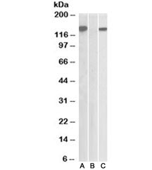 Western blot testing of HEK293 lysate overexpressing human NLRP2/NBS1 with DYKDDDDK tag with NBS1 antibody [1ug/ml] in Lane A and probed with anti-DYKDDDDK tag (1/5000) in lane C. Mock-transfected HEK293 probed with NBS1 antibody [1ug/ml] in Lane B.