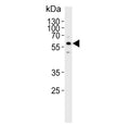 Western blot testing of human SK-BR-3 cell lysate with Cytochrome P450 3A5 antibody. Predicted molecular weight ~57 kDa.