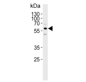 Western blot testing of human SK-BR-3 cell lysate with Cytochrome P450 3A5 antibody. Predicted molecular weight ~57 kDa.