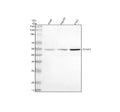 Western blot analysis of CYP4F2 using anti-CYP4F2 antibody. Lane 1: human whole cell lysates, Lane 2: human HepG2 whole cell lysates, Lane 3: human K562 whole cell lysates. After electrophoresis, proteins were transferred to a nitrocellulose membrane at 150 mA for 50-90 min. Blocked the membrane with 5% non-fat milk/TBS for 1.5 hour at RT.