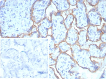 IHC staining of FFPE human placental tissue with PD-L1 antibody (clone PDL1/8408R). HIER: boil tissue sections in pH 9 10mM Tris with 1mM EDTA for 20 min and allow to cool before testing.