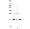 Western blot testing of 1) human HeLa and 2) mouse spleen lysate with TSLP antibody at 0.5ug/ml. Predicted molecular weight ~18 kDa.