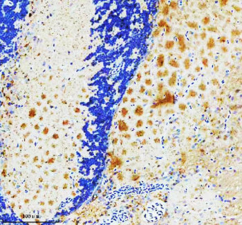IHC staining of FFPE zebrafish brain tissue with Zebrafish Pgk1 antibody. HIER: boil tissue sections in pH8 EDTA for 20 min and allow to cool before testing.
