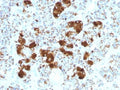 IHC testing of FFPE human pituitary gland with ACTH antibody (clone SPM501). Required HIER: steam sections in pH 9 10mM Tris with 1mM EDTA for 10-20 min.