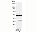 Western blot testing of human samples with CLEC4E antibody at 2ug/ml.