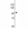 Western blot analysis of NLRP3 antibody and MDA-MB231 lysate. Predicted molecular weight ~118kDa.
