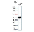 Western blot testing of human brain tissue with Glial fibrillary acidic protein antibody (clone GFAP/9425). Predicted molecular weight ~50 kDa.