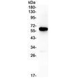 Western blot testing of human placenta lysate with CD138 antibody at 0.5ug/ml. Predicted molecular weight ~32 kDa but often observed higher due to glycosylation.