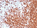IHC staining of FFPE human tonsil tissue with recombinant CD20 antibody (clone MS4A1/7015R). HIER: boil tissue sections in pH 9 10mM Tris with 1mM EDTA for 20 min and allow to cool before testing. HIER: boil tissue sections in pH 9 10mM Tris with 1mM EDTA for 20 min and allow to cool before testing.